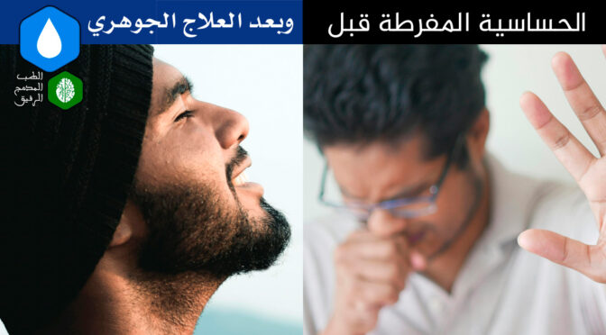 الحساسية المفرطة قبل وبعد العلاج الجوهري، علاج الضبط المجموعي الجوهري ، طب مدمج ، الطب المدمج ، الطب المدمج الرفيق ، الطب النبوي ، الطب الوظيفي ، الطب اليوناني ، الطب الصيني ، طب الضبط الحيوي ، طب الأسنان الشمولي ، طب الأسنان الحيوي ، طب الأسنان المدمج الرفيق ، جميل عواد السلمي ، مؤسس الطب المدمج الرفيق ، الأمراض المزمنة ، الأمراض المستعصية ، الآلام المزمنة ، الأمراض المناعية ، أسباب الأمراض ، منهج الضبط المجموعي الفائق ، علاج الضبط المجموعي الجوهري ، الحجامة ، الإبر الصينية ، الأستيوباثى ، تقويم الفقرات ، الزيوت العطرية ، العلق ، الرقية ، الأمعاء المسربة ، حشوات الزئبق ، الحشوات الفضية ، الأسنان الميتة والتي تعالج عن طريق حشوات العصب ، التجاويف الغير الملتئمة في الفك cavitations ، الزرعات المعدنية ، أقواس النيكل المستخدمة في تقويم الأسنان ، التهاب اللثة المزمن ، ESR Therapy ، Essential Systemic Regulation Therapy ، USR Method ، Ultra Systemic Regulation Method ، آيات الآفاق والأنفس
