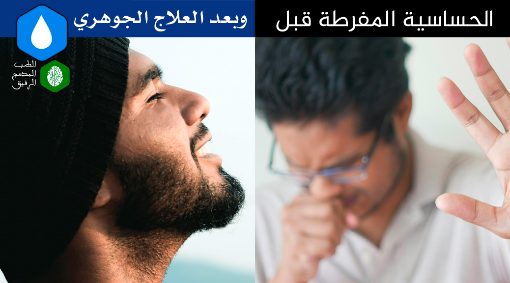 الحساسية المفرطة قبل وبعد العلاج الجوهري، علاج الضبط المجموعي الجوهري ، طب مدمج ، الطب المدمج ، الطب المدمج الرفيق ، الطب النبوي ، الطب الوظيفي ، الطب اليوناني ، الطب الصيني ، طب الضبط الحيوي ، طب الأسنان الشمولي ، طب الأسنان الحيوي ، طب الأسنان المدمج الرفيق ، جميل عواد السلمي ، مؤسس الطب المدمج الرفيق ، الأمراض المزمنة ، الأمراض المستعصية ، الآلام المزمنة ، الأمراض المناعية ، أسباب الأمراض ، منهج الضبط المجموعي الفائق ، علاج الضبط المجموعي الجوهري ، الحجامة ، الإبر الصينية ، الأستيوباثى ، تقويم الفقرات ، الزيوت العطرية ، العلق ، الرقية ، الأمعاء المسربة ، حشوات الزئبق ، الحشوات الفضية ، الأسنان الميتة والتي تعالج عن طريق حشوات العصب ، التجاويف الغير الملتئمة في الفك cavitations ، الزرعات المعدنية ، أقواس النيكل المستخدمة في تقويم الأسنان ، التهاب اللثة المزمن ، ESR Therapy ، Essential Systemic Regulation Therapy ، USR Method ، Ultra Systemic Regulation Method ، آيات الآفاق والأنفس